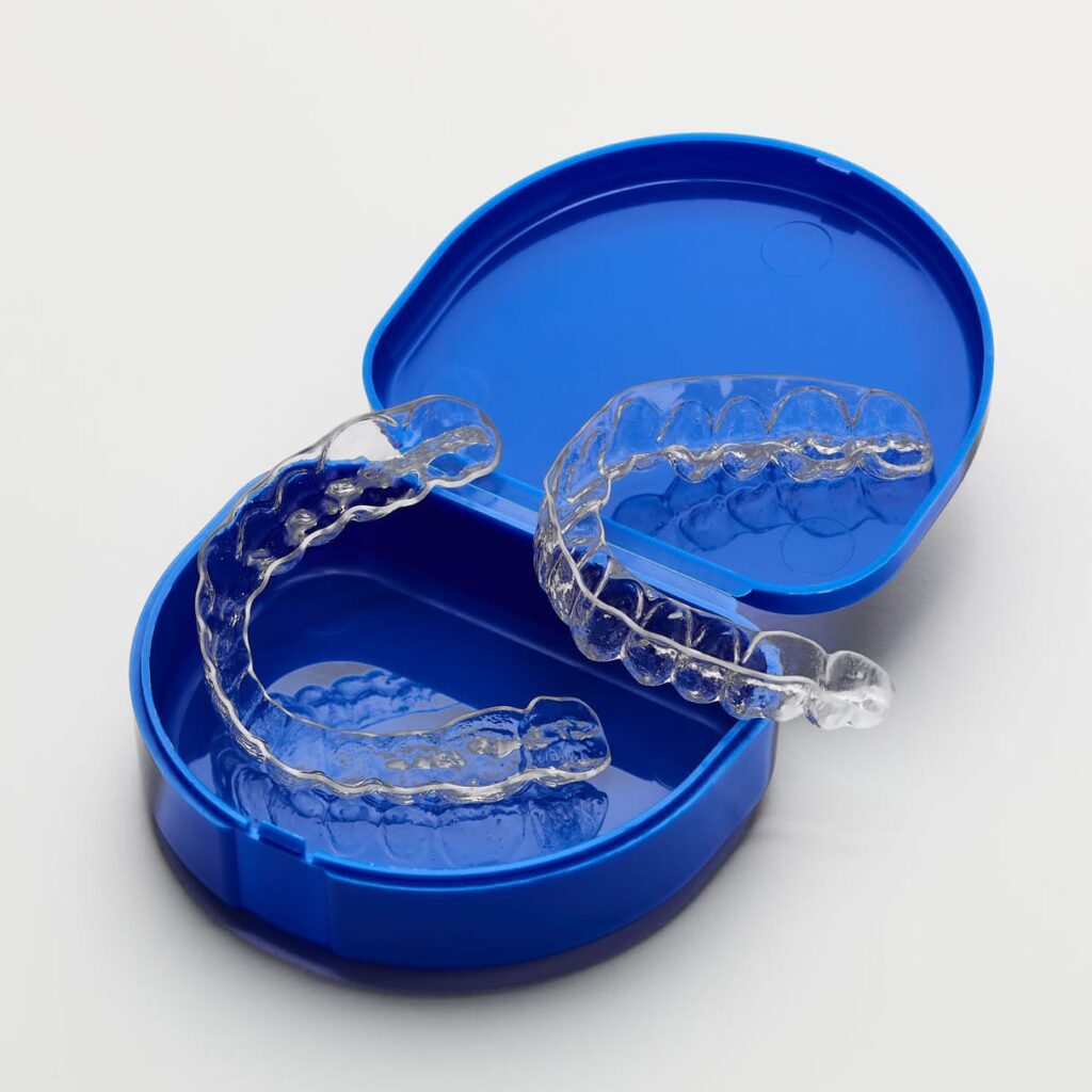 Essix Retainers made from Sporting Smiles