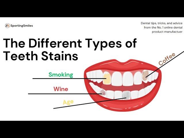 tobacco stained teeth The Different Types of Teeth Stains